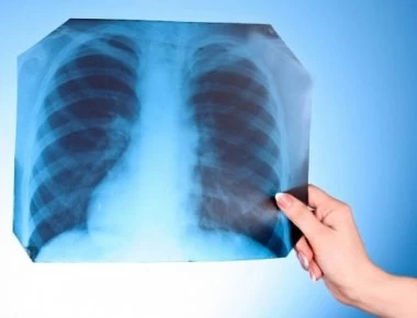 Είχε πόνους για 23 χρόνια στην κοιλιά - Δεν φαντάζεστε τι βρήκαν οι γιατροί